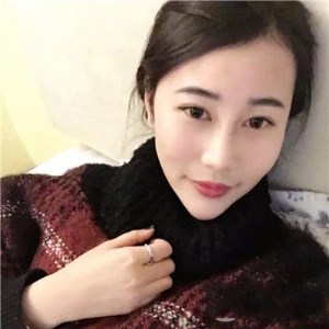 西安美立方李蓉華埋線雙眼皮四個月了，分享恢復(fù)照片~~