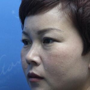 營(yíng)口康藝謝靜半長(zhǎng)期紋眉術(shù)后兩周左右的分享~