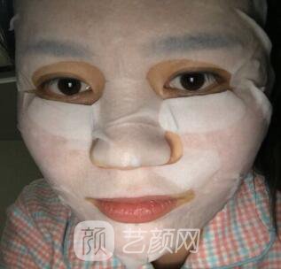 福州比華利林秋蓉激光祛痘圖 滿臉痘痘到光滑肌膚