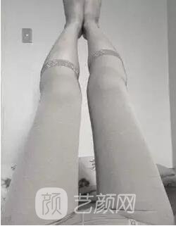 東莞締美陳星光大腿吸脂照片 內附全部恢復過程體驗