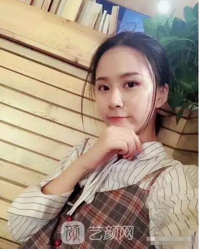 北京上上相鄭楚蓉院長自體脂肪填充全臉圖心情小記