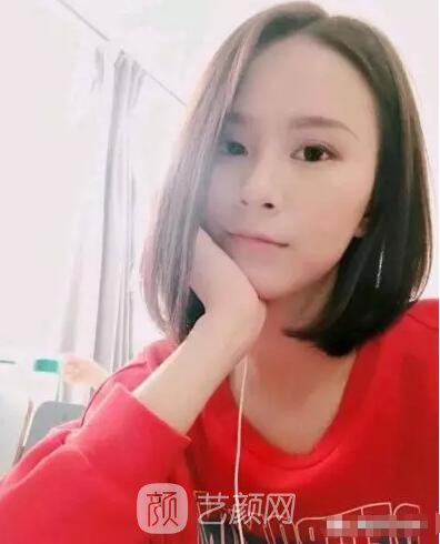 北京上上相鄭楚蓉院長自體脂肪填充全臉圖心情小記
