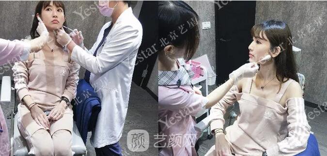 北京藝星整形醫(yī)院注射瘦臉￥499 | 打完半個(gè)月，來看看果!