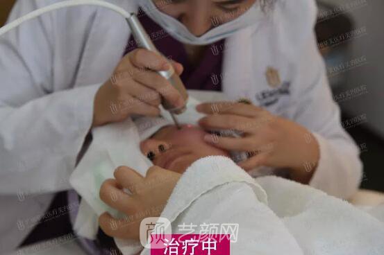 皮-秒激光祛斑案例，恢復(fù)照片分享~