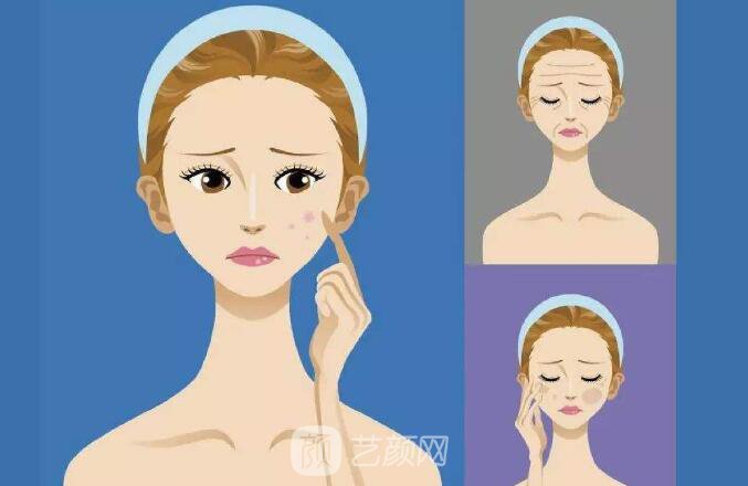 光子嫩膚去毛孔和黑頭