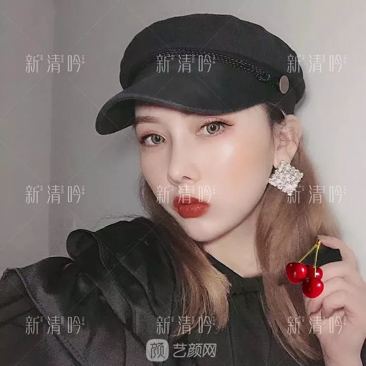 耳軟骨隆鼻果怎么樣？案例照片一覽~