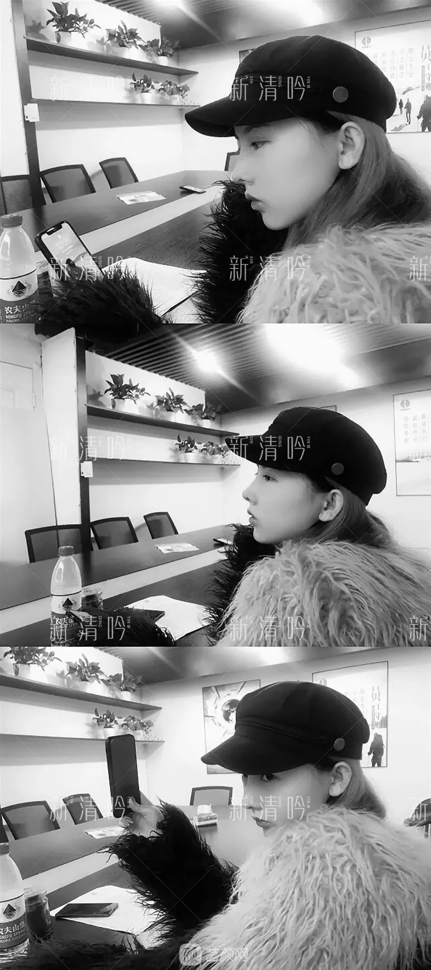 耳軟骨隆鼻果怎么樣？案例照片一覽~