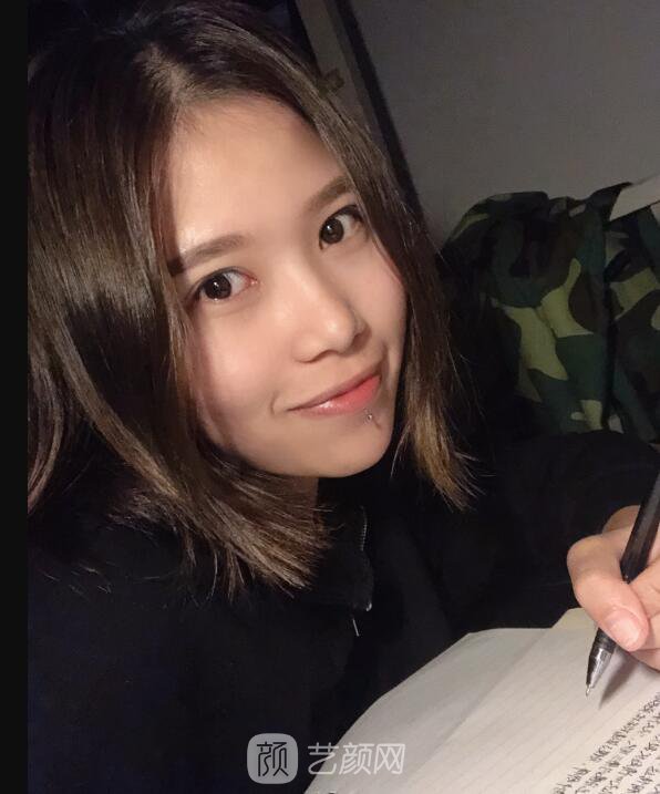 開眼角圖真實(shí)案例分享哦