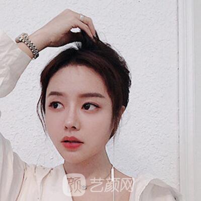 做好發(fā)際線后堪比微調(diào)的真實經(jīng)歷分享