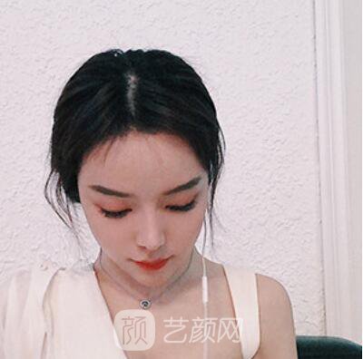 做好發(fā)際線后堪比微調(diào)的真實經(jīng)歷分享