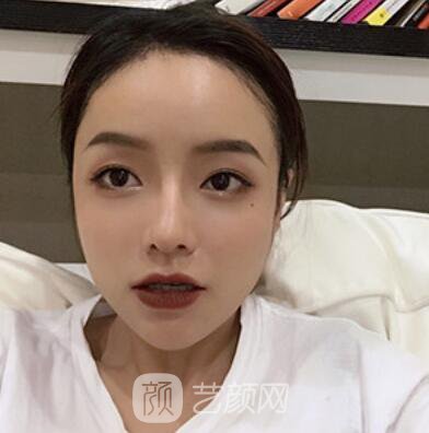 做好發(fā)際線后堪比微調(diào)的真實經(jīng)歷分享