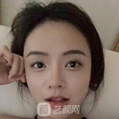 做好發(fā)際線后堪比微調(diào)的真實經(jīng)歷分享