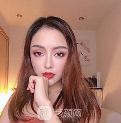 做好發(fā)際線后堪比微調(diào)的真實經(jīng)歷分享