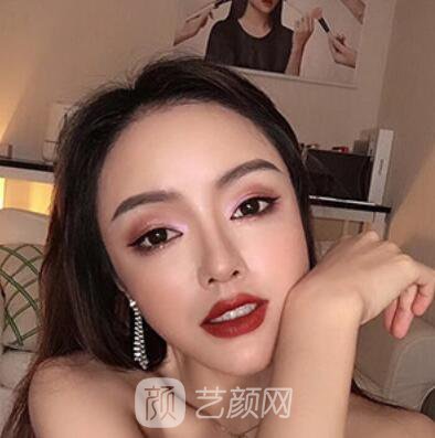 做好發(fā)際線后堪比微調(diào)的真實經(jīng)歷分享