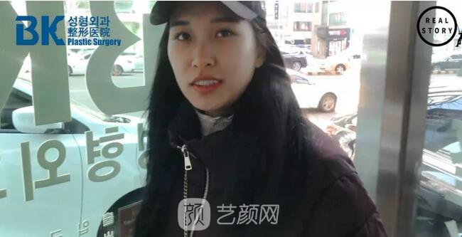 【新西蘭美女整形日記】鼻部手術+面部脂肪移植——BK整形醫(yī)院