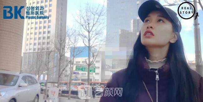 【新西蘭美女整形日記】鼻部手術+面部脂肪移植——BK整形醫(yī)院