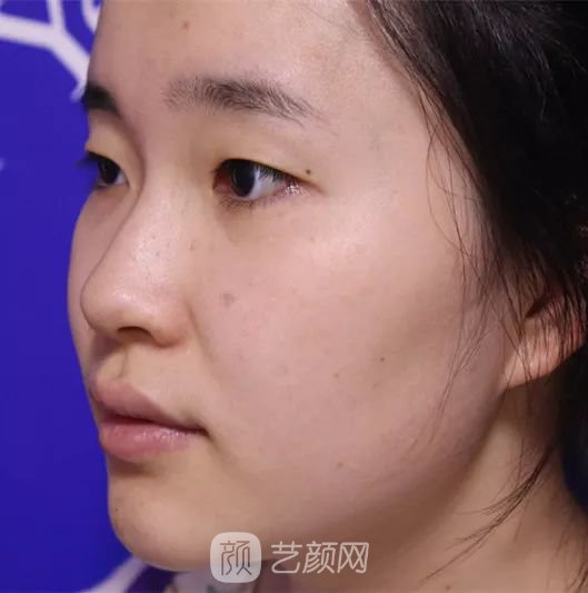 出道三年，她整成這樣終于亮相芒果臺(tái)啦！