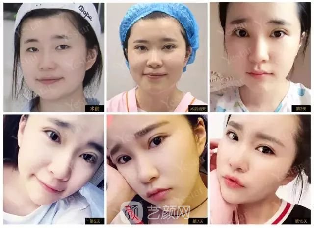 出道三年，她整成這樣終于亮相芒果臺(tái)啦！