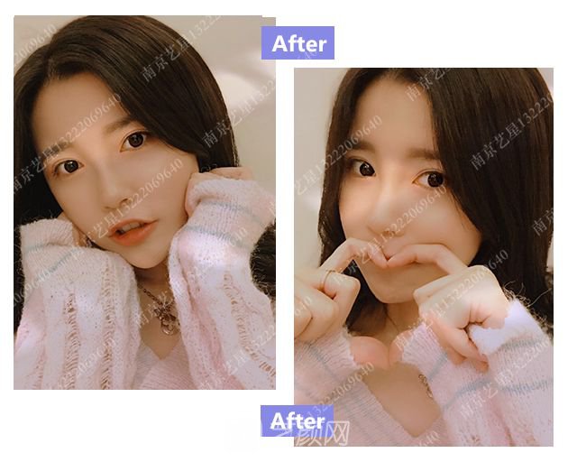 出道三年，她整成這樣終于亮相芒果臺(tái)啦！