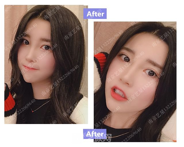 出道三年，她整成這樣終于亮相芒果臺(tái)啦！