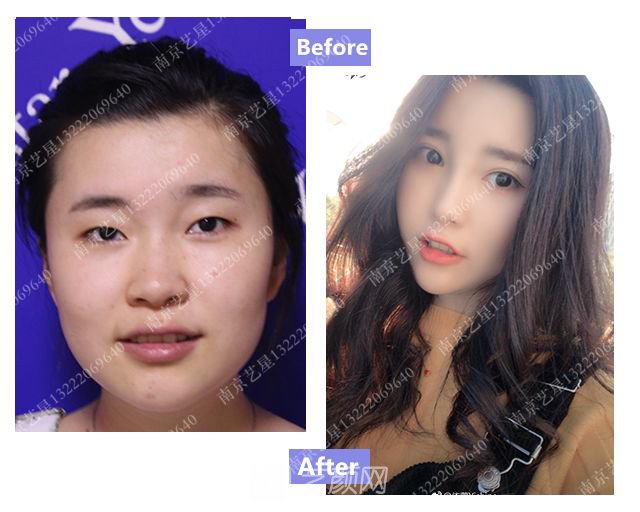 出道三年，她整成這樣終于亮相芒果臺(tái)啦！