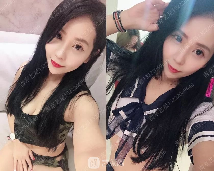 只需要5分鐘，我的鼻子變高了！——南京藝星玻尿酸隆鼻~