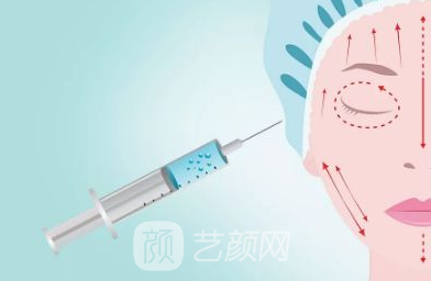 成都建麗玻尿酸注射多少錢(qián)一支?