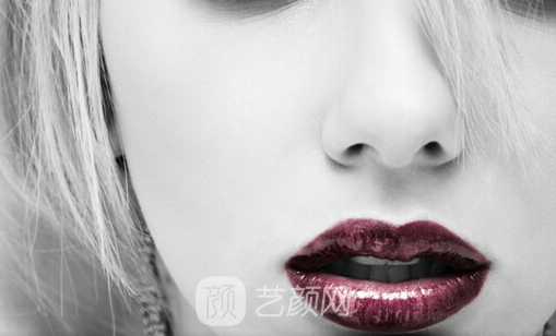 深圳恩吉娜做了下巴和鼻子，鼻型挺起來了