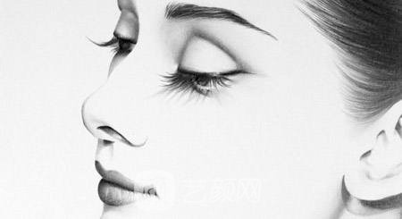 北京愛悅麗整形隆鼻術(shù)后果及保養(yǎng)事項(xiàng)