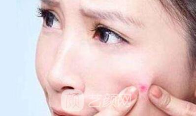 滿臉的紅疙瘩在治好啦!