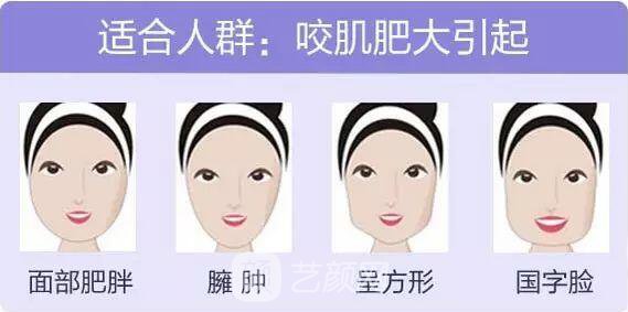 玻尿酸隆鼻+注射瘦臉讓你一目了然