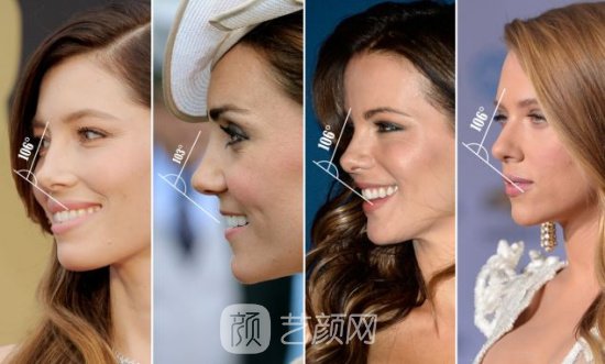 隆鼻案例：隆鼻+雙眼皮+下巴已經(jīng)不是原來自卑的我了~