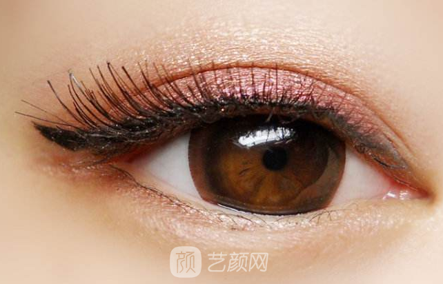 南山醫(yī)院柯于清談:割雙眼皮有哪些常見(jiàn)問(wèn)題