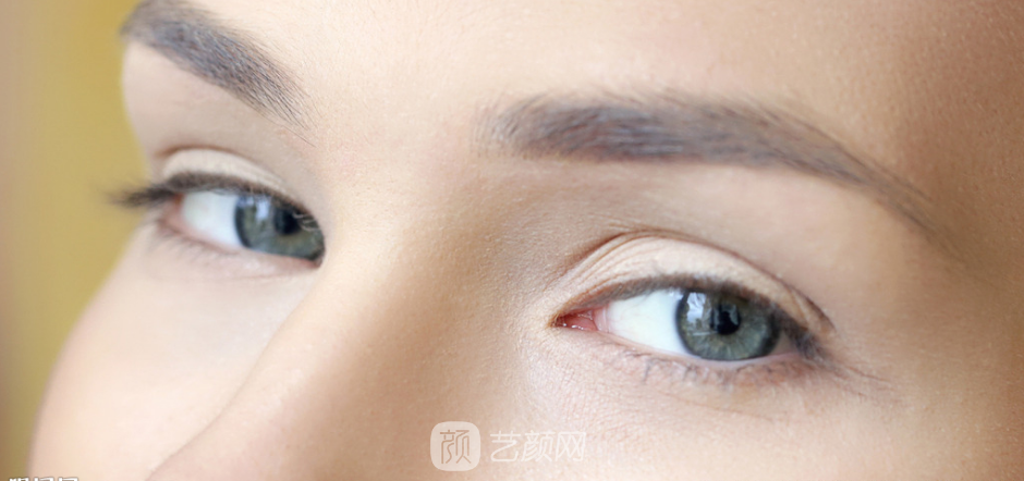 雙眼皮要怎么割，才能別人才看不出來