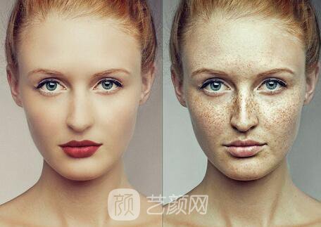 調(diào)節(jié)黃褐斑是長(zhǎng)期的工程，需要堅(jiān)持才能見(jiàn)果