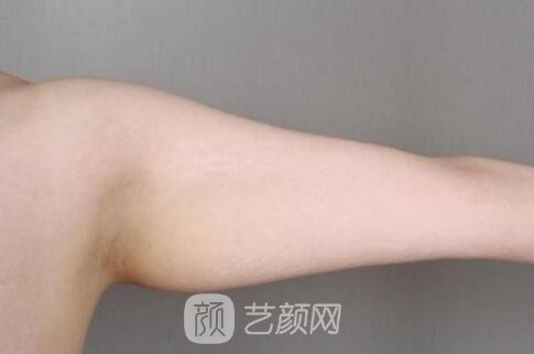 全新項(xiàng)目吸脂所讓顧客困擾的問題有哪些?