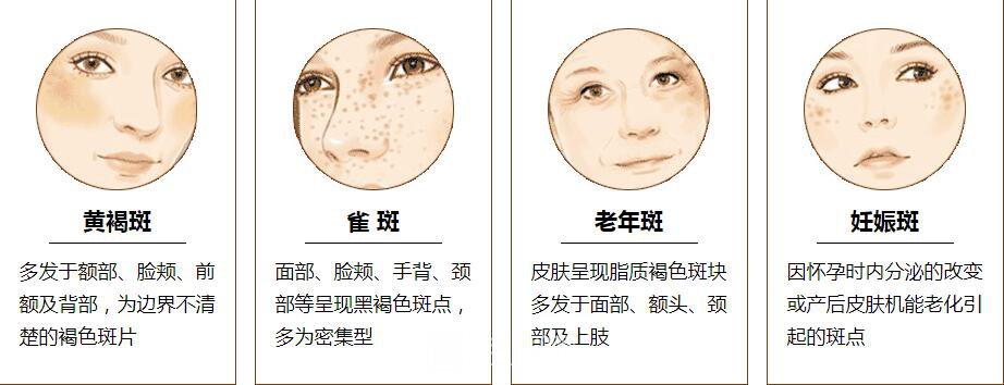 祛斑后不用化妝，我也可以一樣美麗。