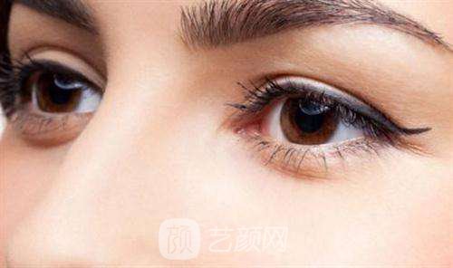 雙眼皮術(shù)后,必須經(jīng)歷的五個(gè)階段?