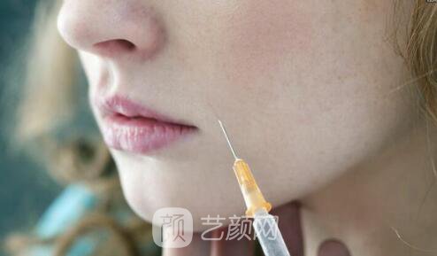 自己養(yǎng)出來的淚溝 玻尿酸幫我消滅