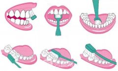 開講啦！種植牙護(hù)理大課堂鼓樓專場，上門就送598元大禮包！