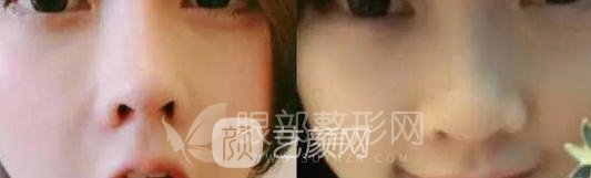 斗魚第一女主播馮提莫的進(jìn)化史：從素人到網(wǎng)紅！