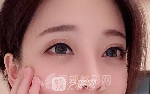 斗魚第一女主播馮提莫的進(jìn)化史：從素人到網(wǎng)紅！