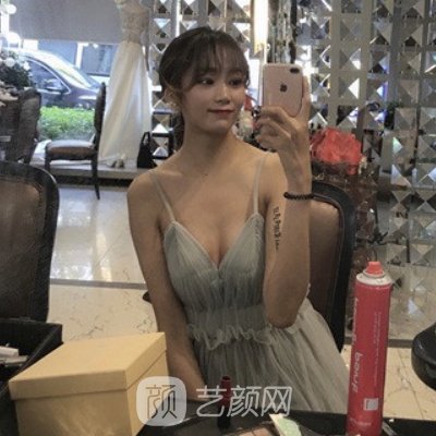 長(zhǎng)沙劉超峰醫(yī)生做鼻修復(fù)怎么樣？2022招牌案例公布