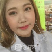 北京八大處王歡隆鼻案例