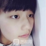 株洲中心醫(yī)院割雙眼皮的