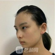 天津伊美爾桃花翹睫雙眼