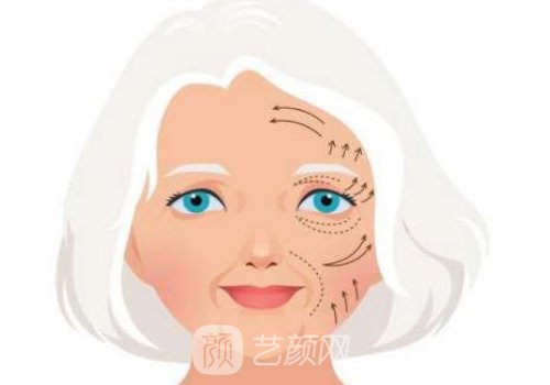 馮立哲面部提升價(jià)格是多
