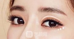 撫順做雙眼皮多少錢？撫