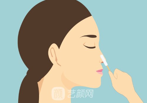 珠?？泼勒吾t(yī)院縮鼻翼