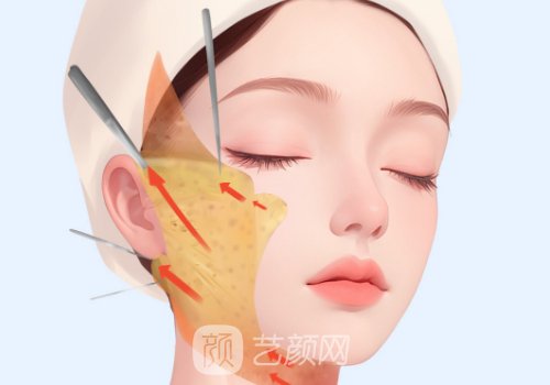 八大處趙延勇拉皮價格是